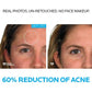 La Roche Posay Effaclar Dermatological Acne Treatment 3-Step System Kit Medicated Gel Cleanser 7.5 fl oz - Imperfect Box