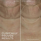 RoC Derm Correxion Retinol Face Stick - Imperfect Box