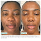 Urban Skin Rx Youth Hero 2-in-1 AM Serum & PM Serum - Imperfect Box