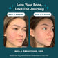 Proactiv MD 30 Day Acne Treatment Kit 3pc EXP 11/2026 - Imperfect Box