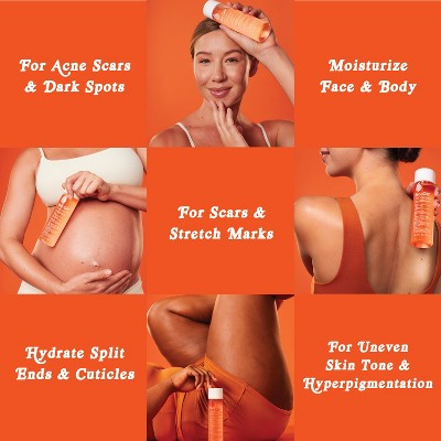 Bio-Oil Skincare Body Oil and Scar Treatment with Vitamin E 4.2 fl oz - Imperfect Box