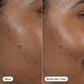 Hero Cosmetics Dark Spot Correct 10ml - New