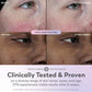 Olay Super Face Serum with Vitamin C 1 fl oz - Imperfect Box