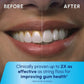 Waterpik Cordless Plus Rechargeable Water Flosser WP-462 Black - Imperfect Box