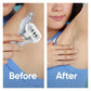 Venus Extra Smooth Sensitive Women's Razor Blade Refills 7ct - Missing Box