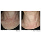 RoC Face & Neck Anti-Aging Moisturizer Firming Cream for Crepey Skin 1.7 fl oz - Imperfect Box