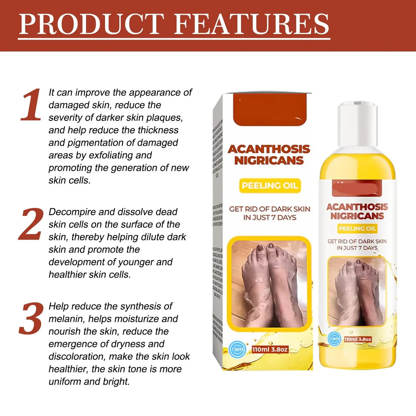 Acanthosis Nigricans Peeling Oil for Dark Spots 110ml