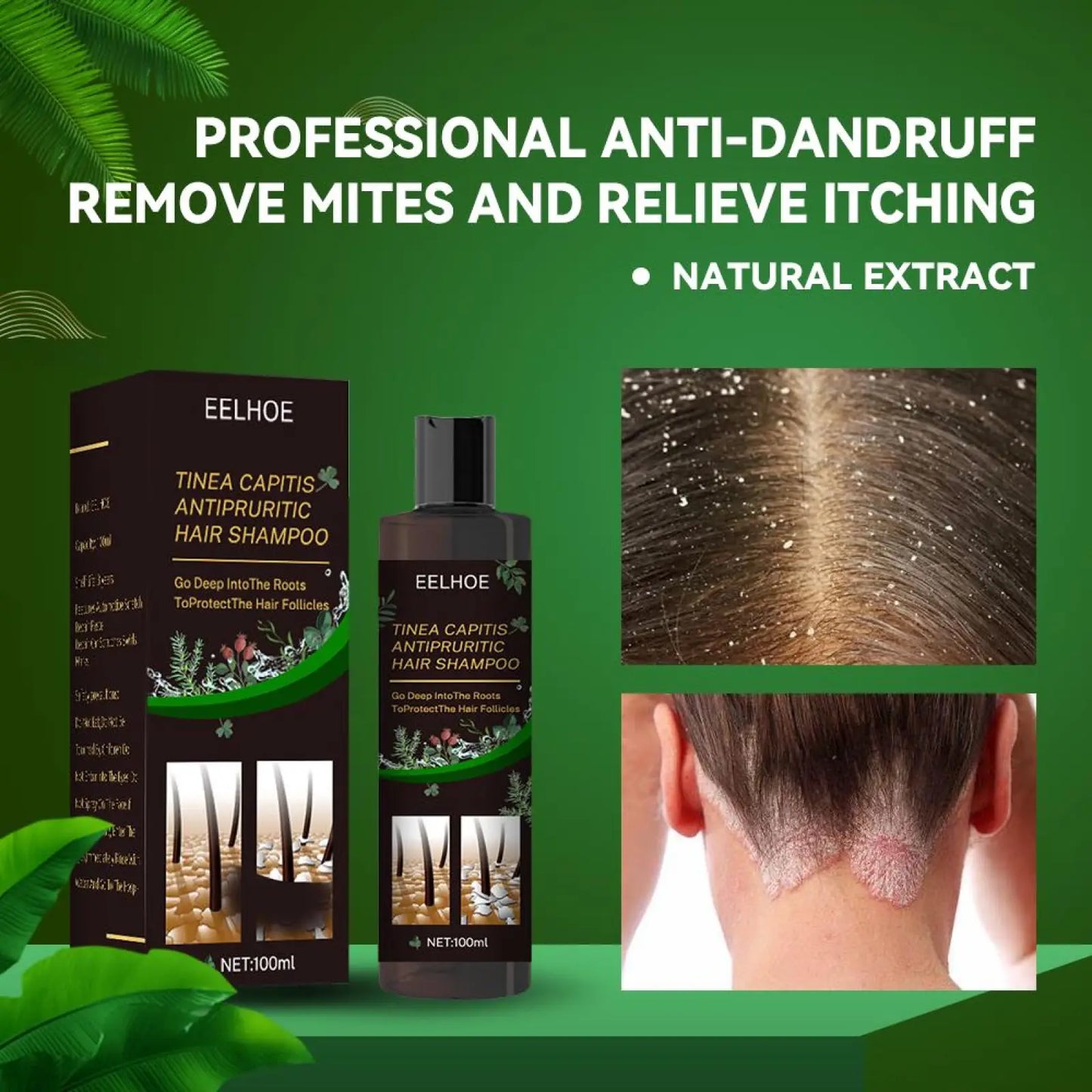 Anti-dandruff Shampoo for Itch Relief and Oil Control