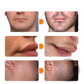 Beard Growth Spray and Derma Roller Kit 30ml