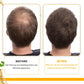 Biotin Hair Growth Oil for Thick and Smooth Hair Care
