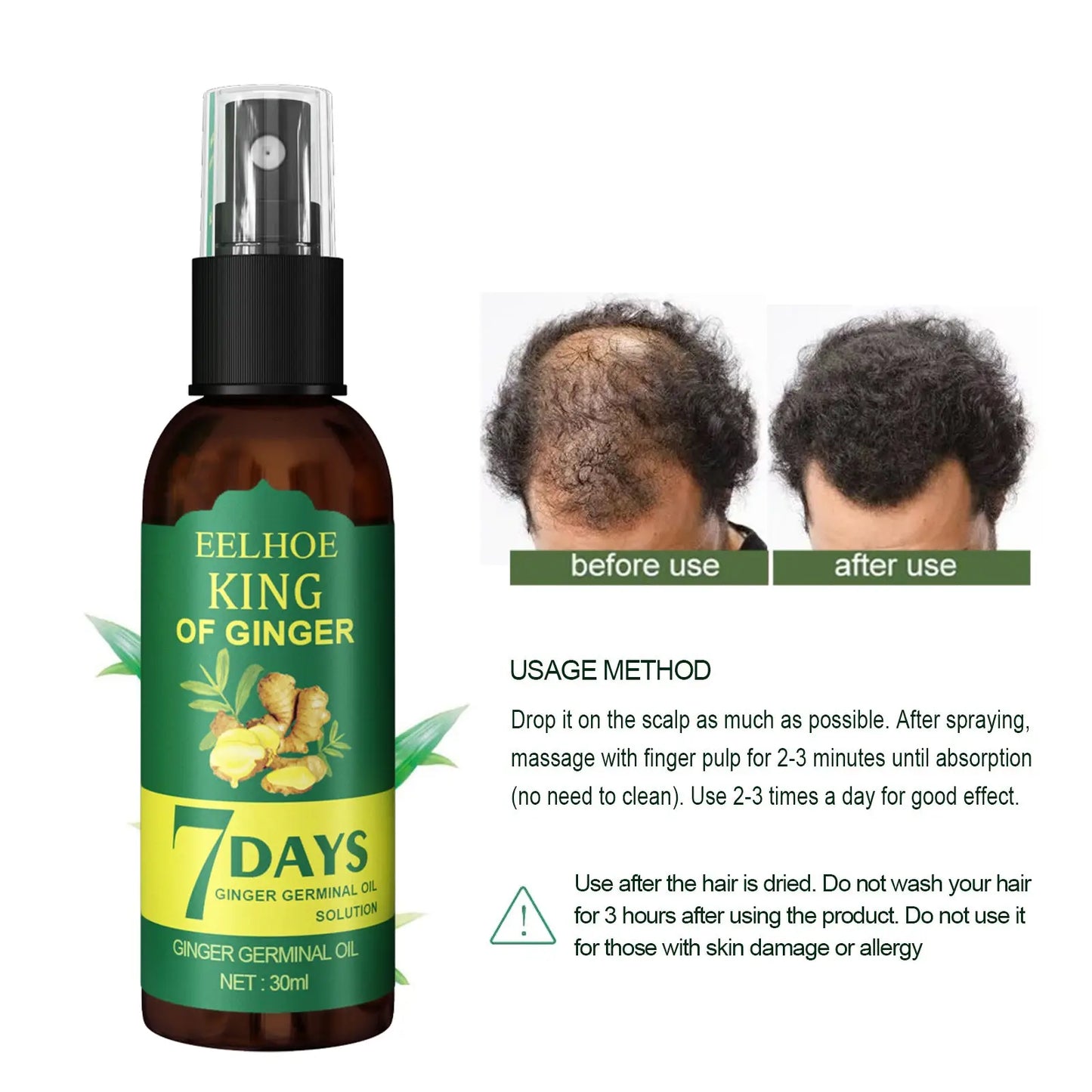 Eelhoe King of Ginger Hair Growth Spray 30ml Strengthening Oil