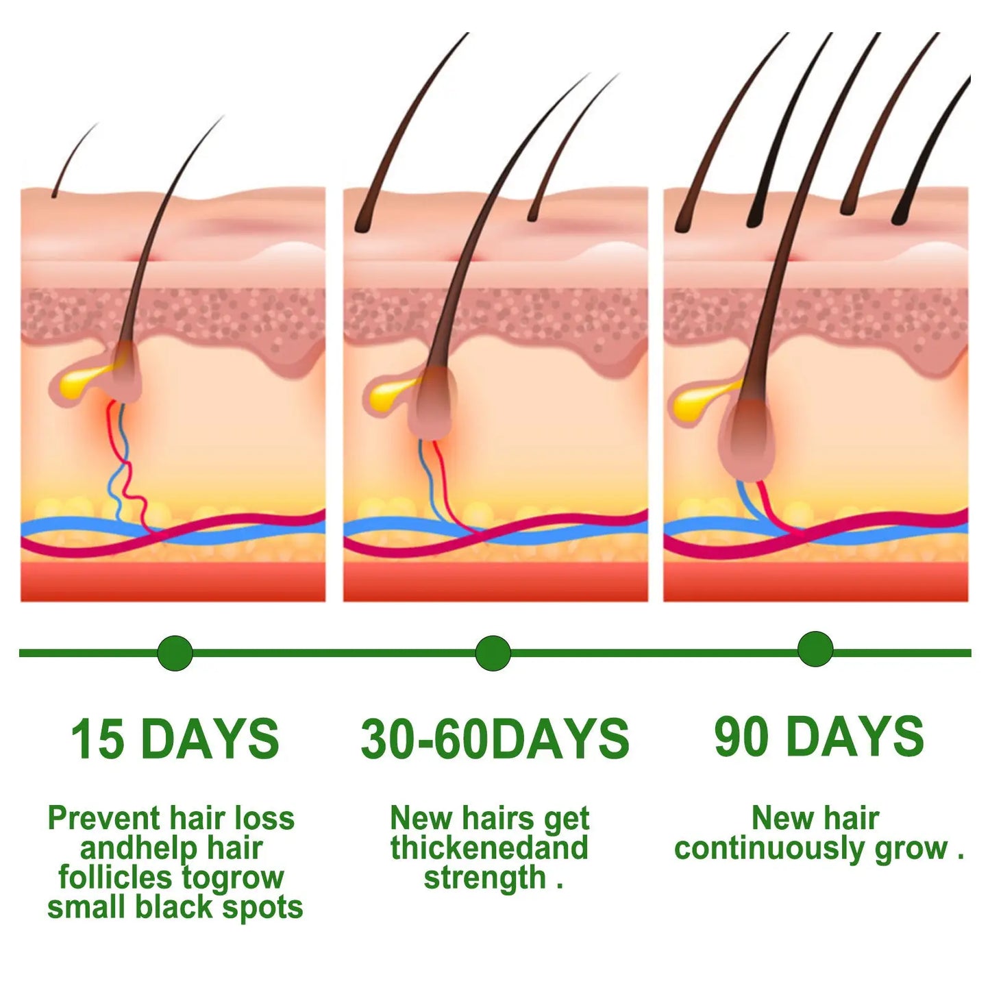 Eelhoe Rosemary Hair Growth Oil and Dermaroller Set