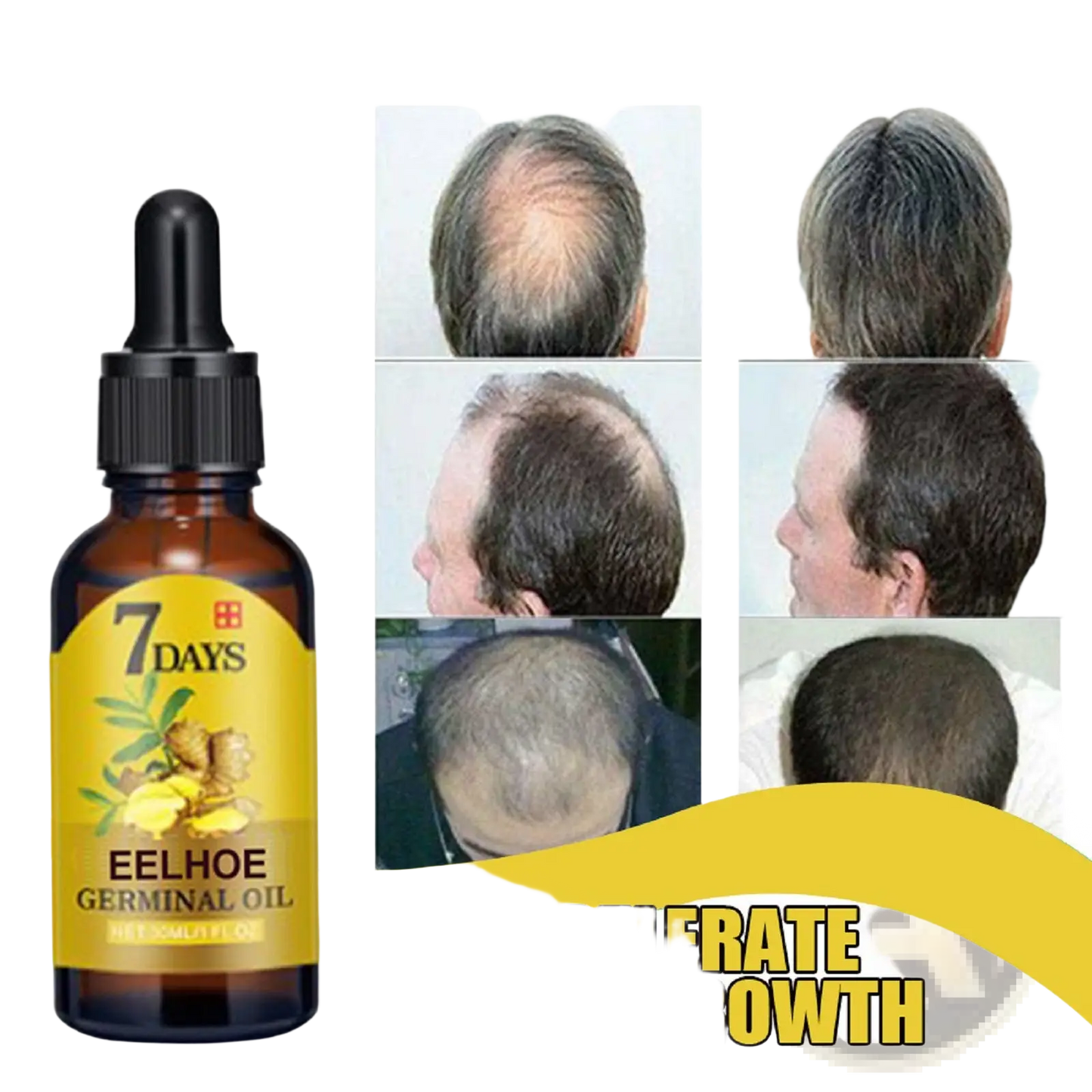 Ginger Hair Growth Oil 7 Days Anti Hair Loss Serum