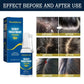 West and Month Hair Follicle Root Repair Essence Spray