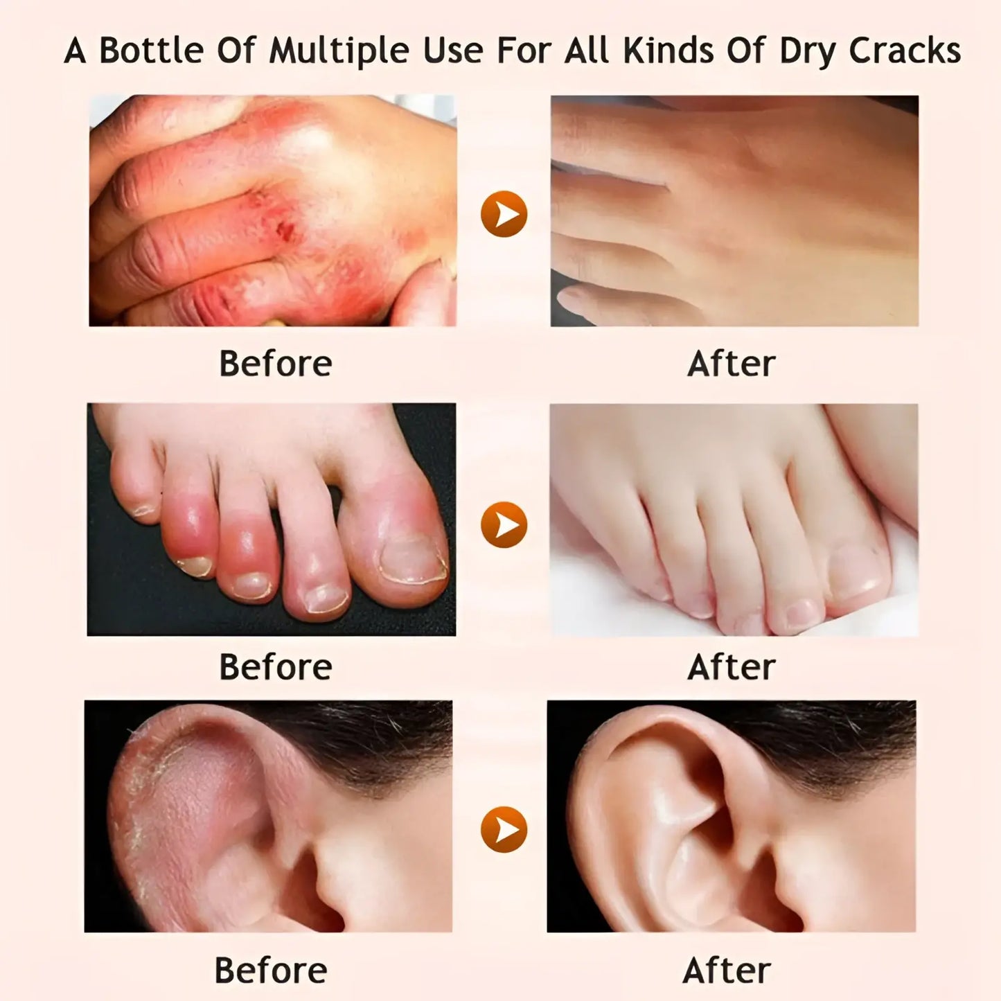 Honey Foot Cream and Gel Sock Moisturizing Set