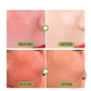 Matte Sun Stick Spf 50 Moisturizing Skincare Cream