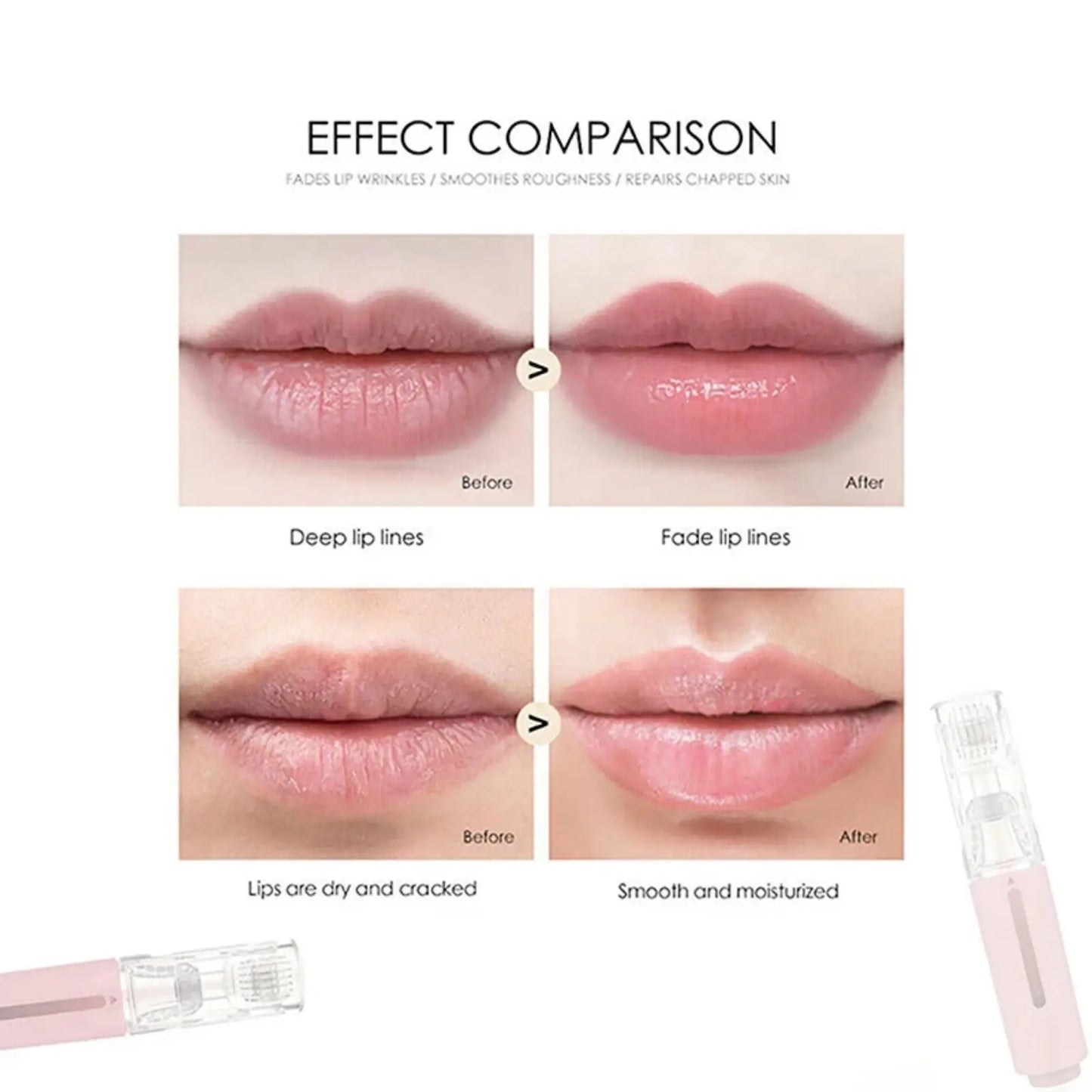 Microneedle Hydration Roller for Lip and Beard Serum