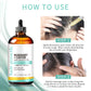 Rosemary Castor Hair Growth Oil 118ml Treatment