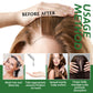 Rosemary Essential Oil for Hair Growth 60ml Ouhoe