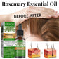 Eelhoe Rosemary Essential Oil for Hair Growth and Scalp Care