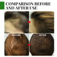 Eelhoe Rosemary Essential Oil for Hair Growth and Scalp Care