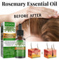 Eelhoe Rosemary Essential Oil for Hair Growth and Scalp Care